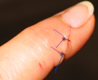 finger 2